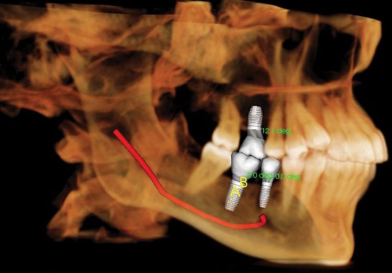 startlight-dental-clinic-scan-ct-3d
