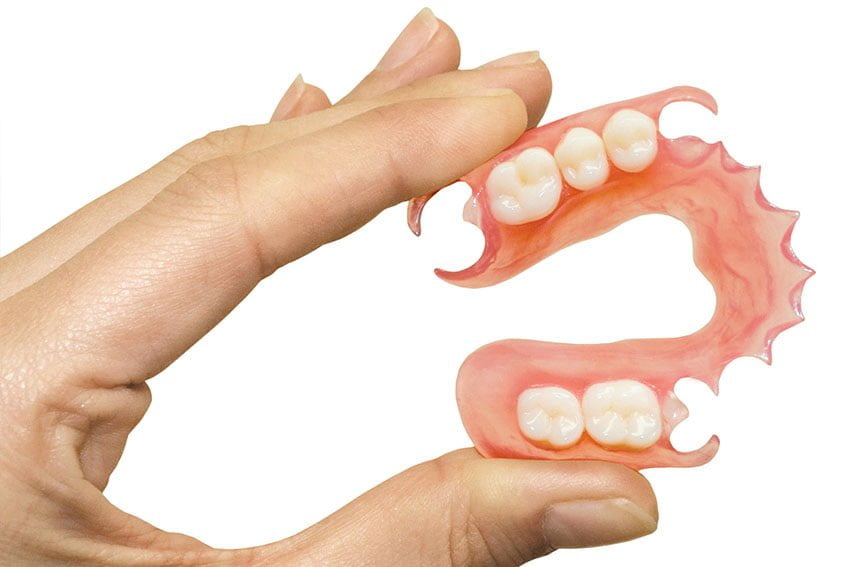 Starlight-dental-clinic-denture-rang-gia-thao-lap