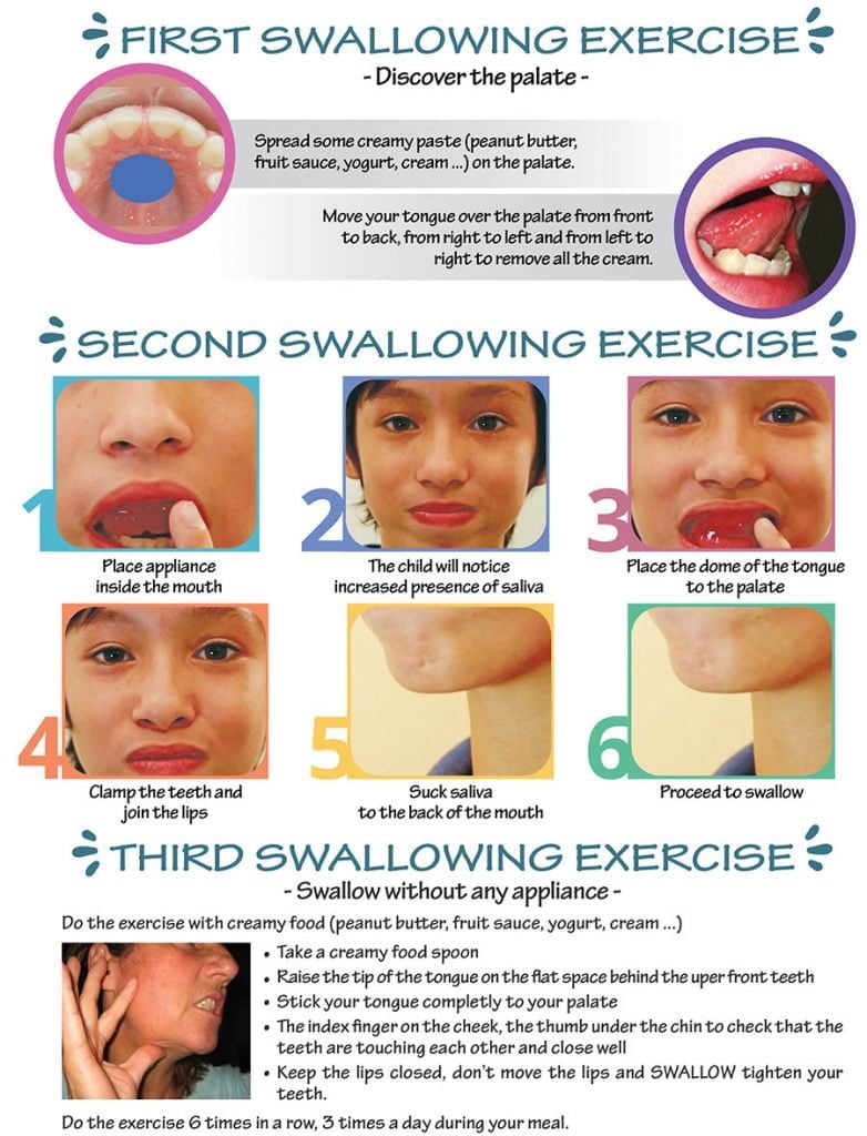 Early Orthodontic & Functional Treatment Starlight Dental Clinic