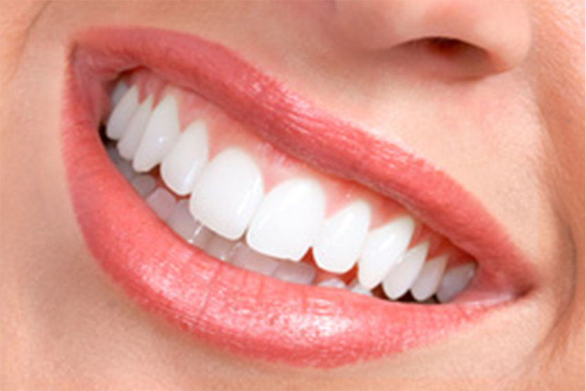 Starlight-dental-clinic-gum-care